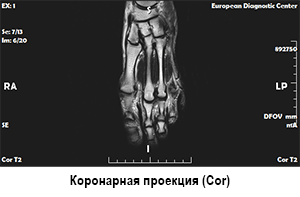 сделать мрт стопы, цена