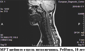 мрт шеи ребенку